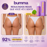 Antes e depois 28 dias
